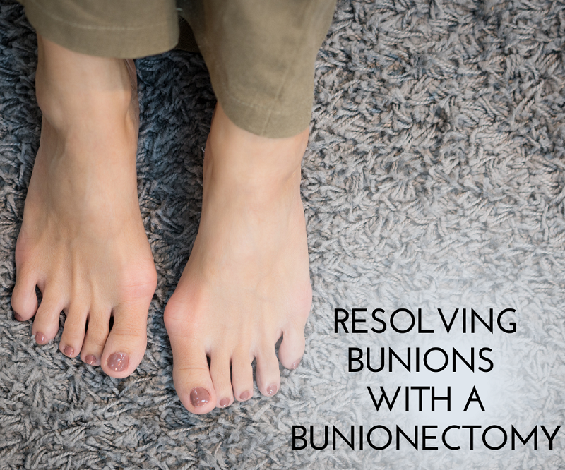 Bunions W Lancaster, SC 