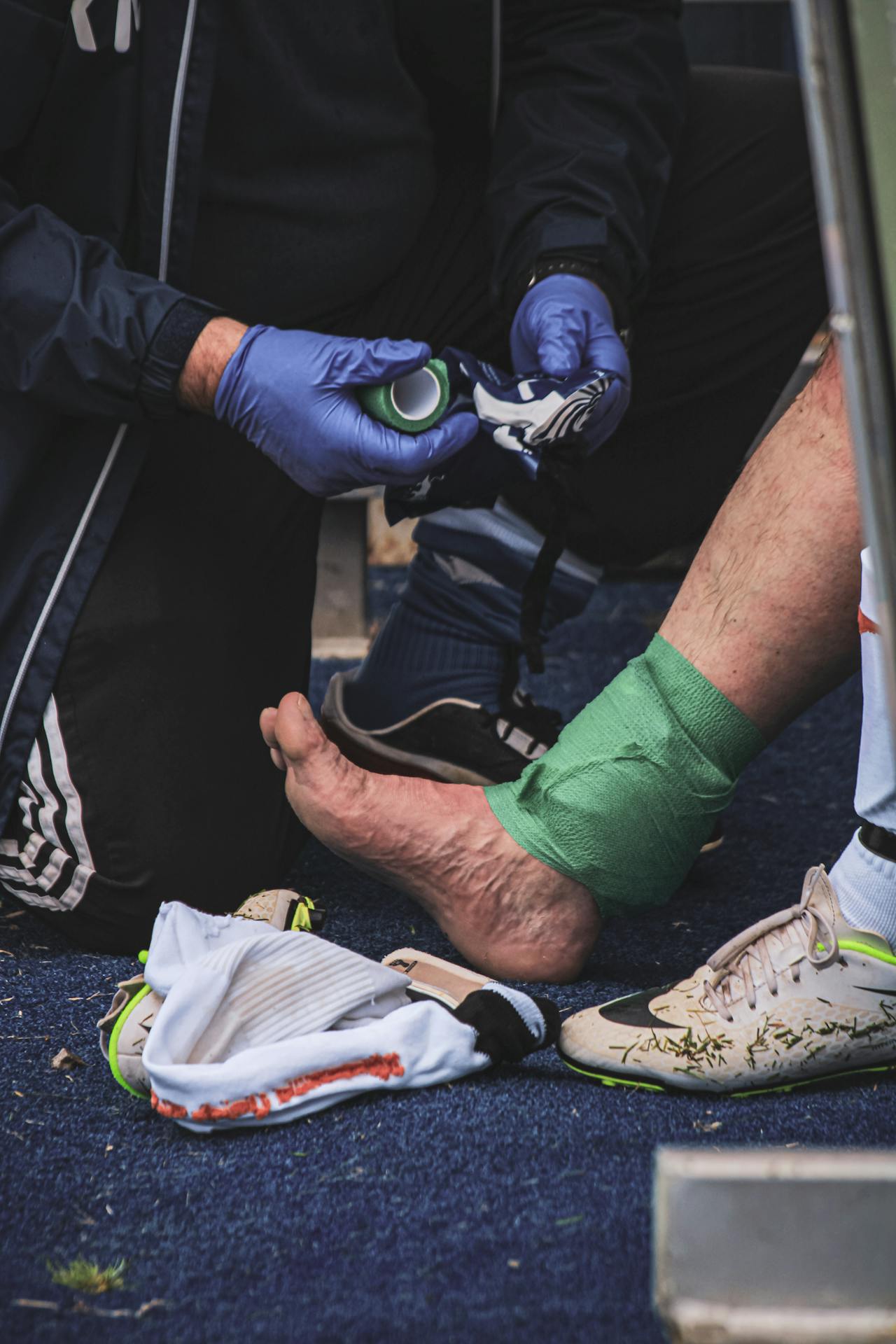 Trauma Foot Surgery and Recovery W Lancaster, SC